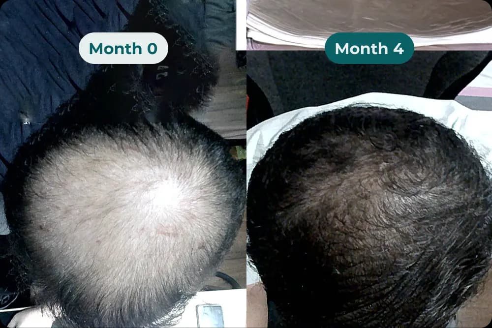 Jake T. testimonial
